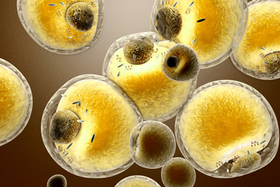Alexion's FDA approves Alexion's Kanuma for LAL deficiency - European ...